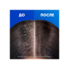 Head & Shoulders Шампунь и бальзам-ополаскиватель против перхоти 2в1 Основной уход, 800 мл